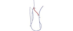 Reversing loop0002 Small.jpg