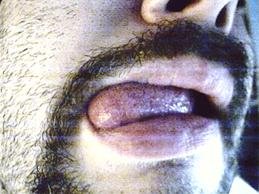 mouth.jpg